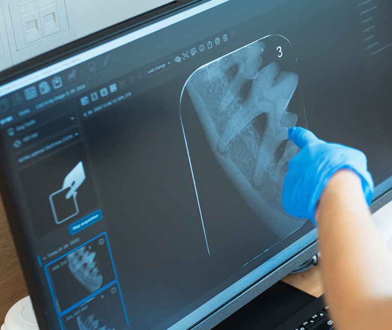 Radiographie dentaire