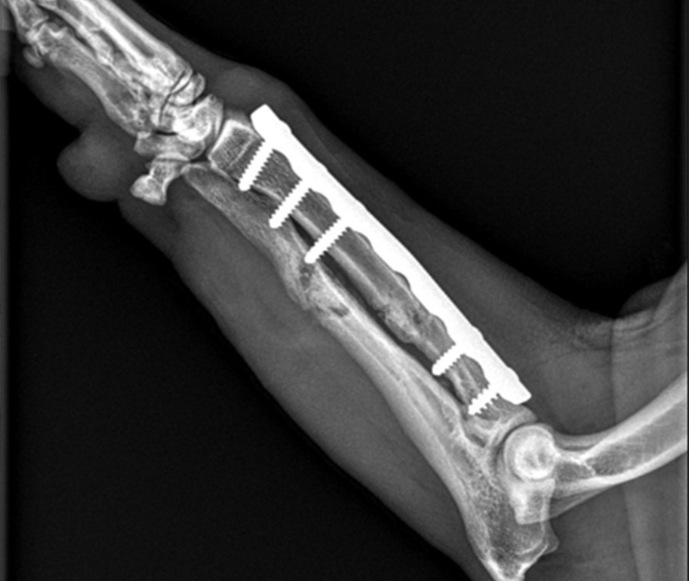 Chirurgie orthopédique